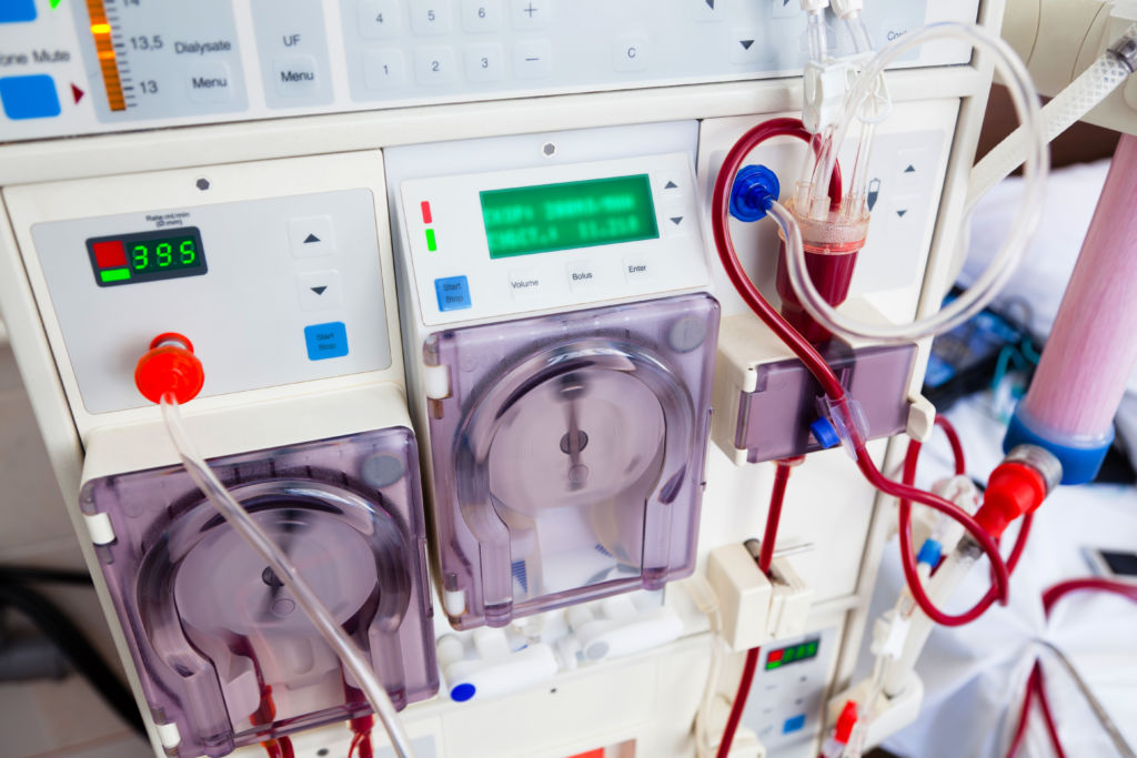 Artificial kidney (dialysis) device with rotating pumps. Closeup view.